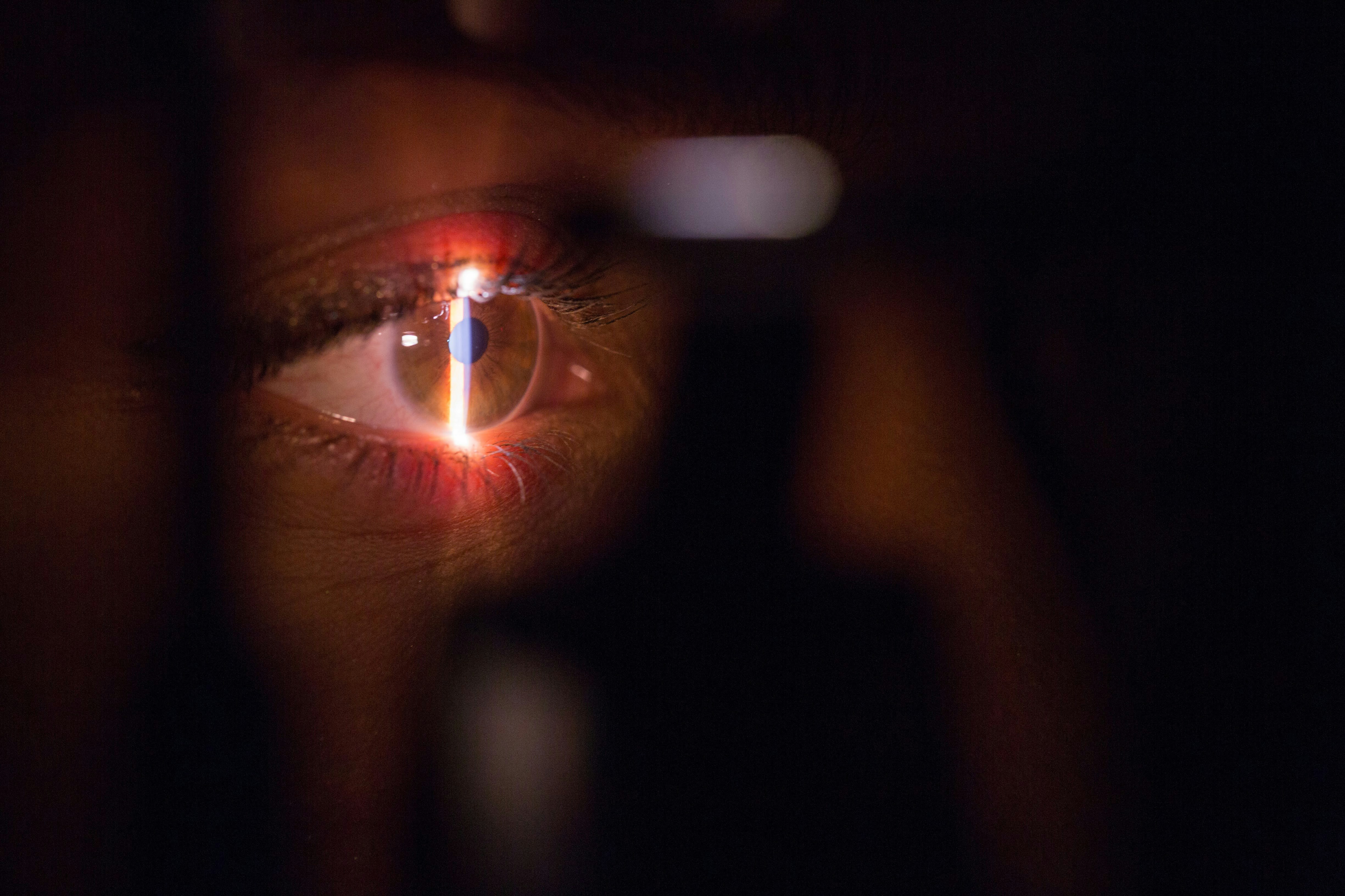 tratamiento ocular